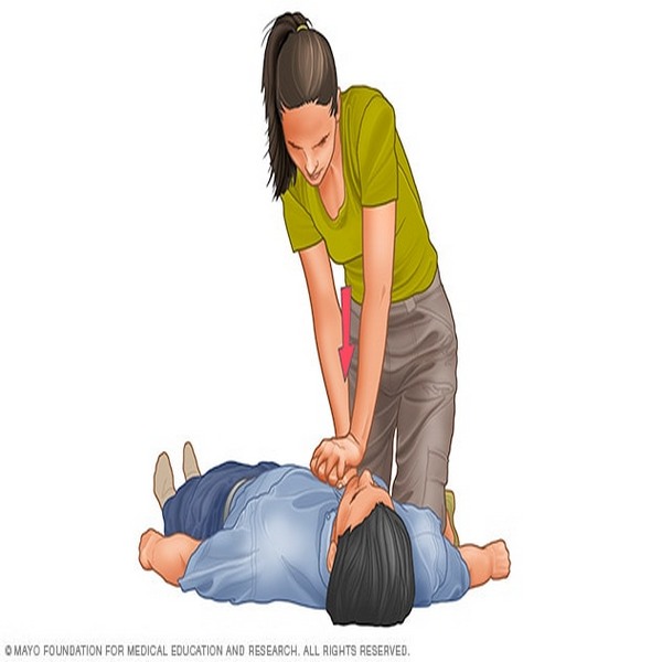 Cardiopulmonary Resuscitation (CPR): First aid